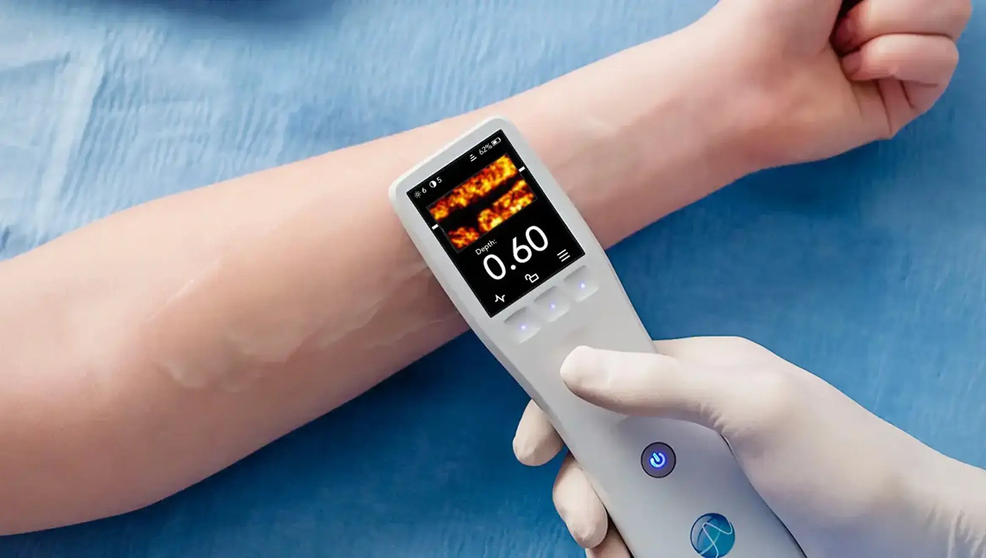 BK Ultrasound's portable ultrasound device